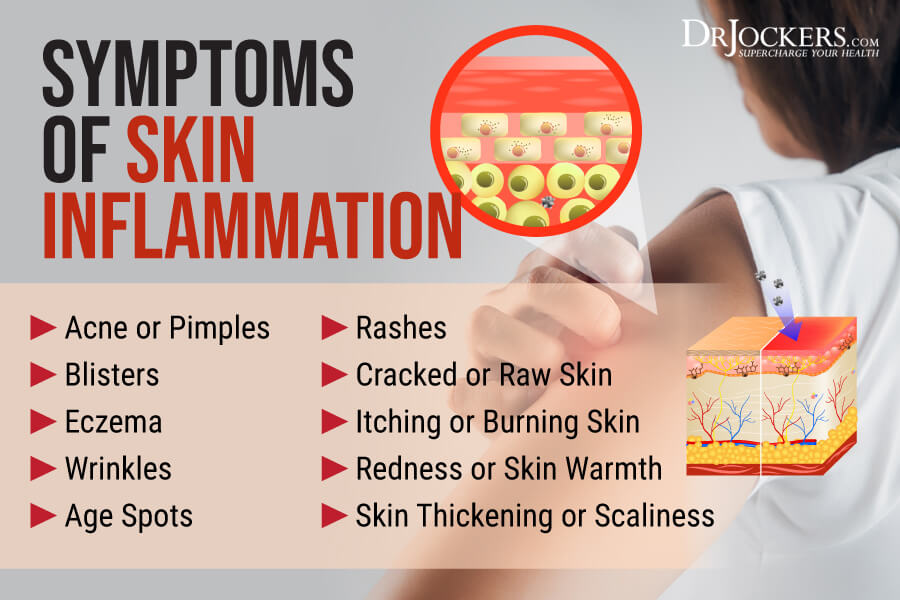 skin inflammation, Skin Inflammation: Symptoms, Causes, and Support Strategies