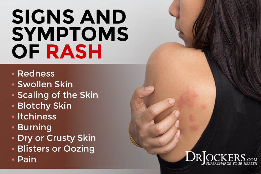 rashes, Skin Rashes: Symptoms, Causes and Natural Support Strategies
