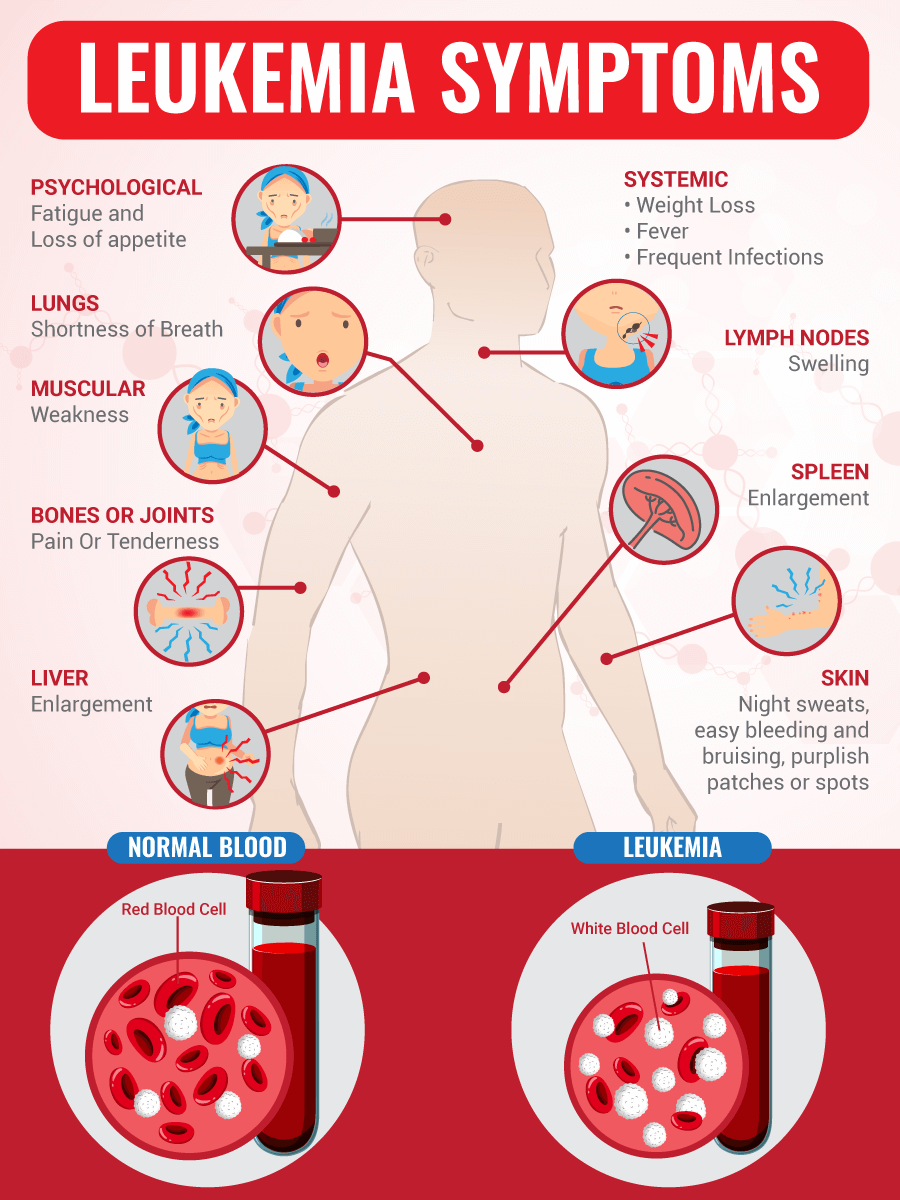 leukemia children symptoms