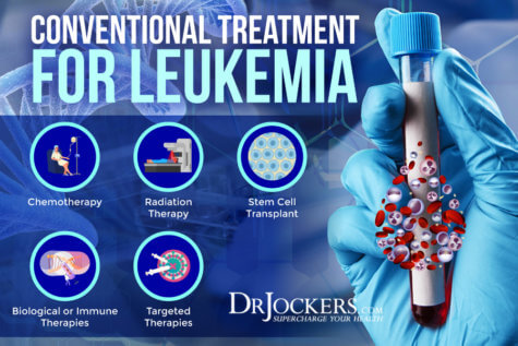 Leukemia: Symptoms, Causes, and Support Strategies - DrJockers.com