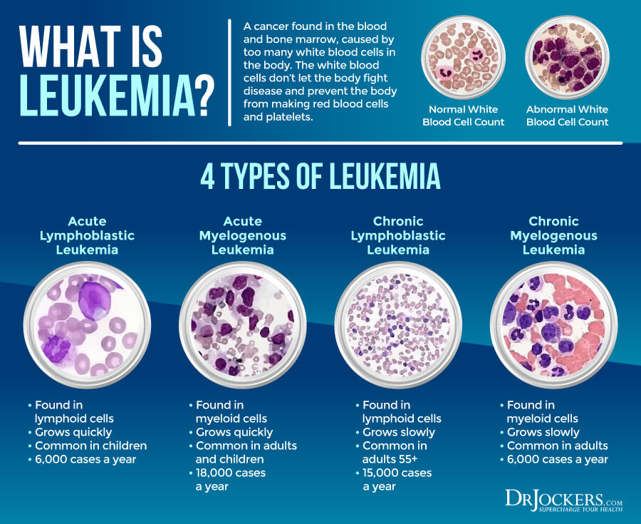 Leukemia Symptoms In Adults