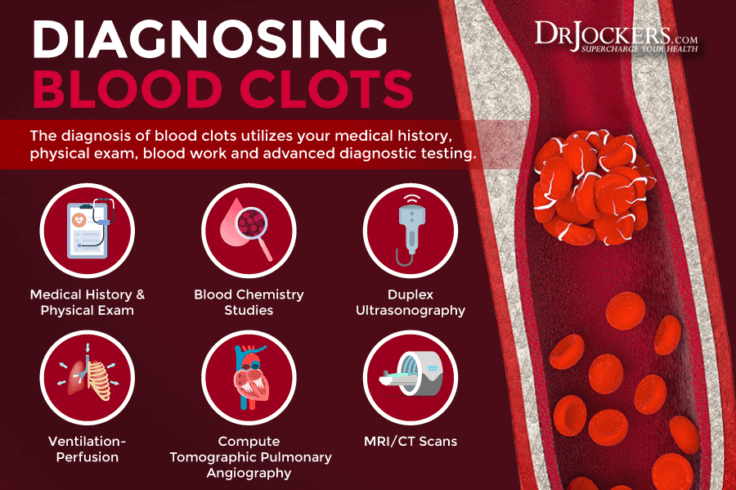 blood-clotting-symptoms-causes-and-support-strategies