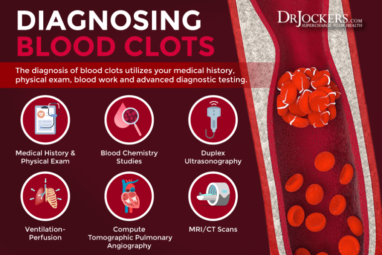 Blood Clotting Symptoms, Causes and Support Strategies