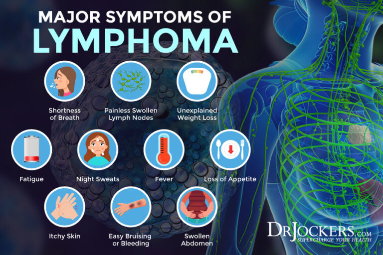 Lymphoma Symptoms, Causes, and Support Strategies