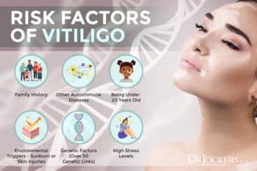 Vitiligo: Symptoms, Causes, And Support Strategies