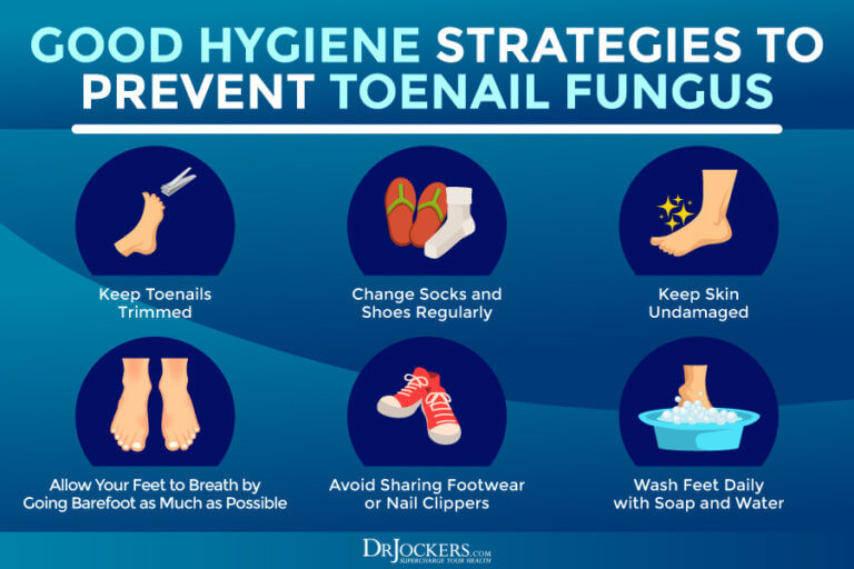 Toenail Fungus: Symptoms, Causes and Support Strategies