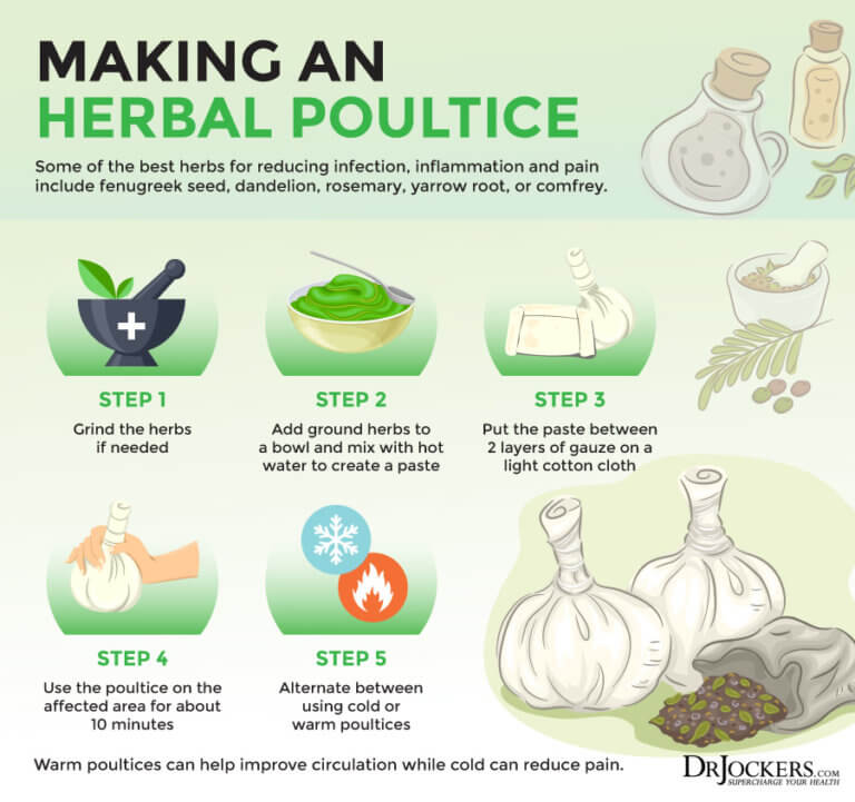 Mastitis During Breastfeeding Symptoms and Support Strategies