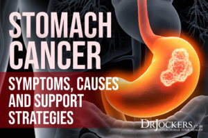 Stomach Cancer: Symptoms, Causes, and Support Strategies