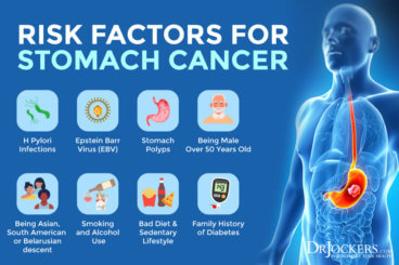 Stomach Cancer: Symptoms, Causes, and Support Strategies