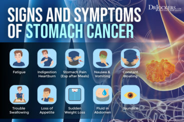 Stomach Cancer: Symptoms, Causes, and Support Strategies