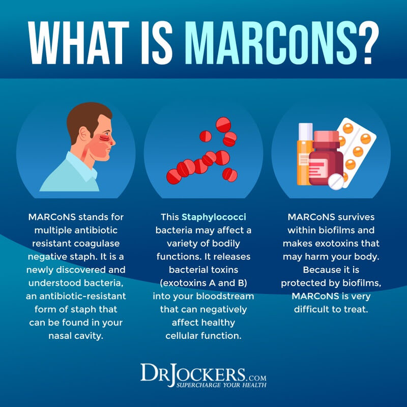 MARCoNS, MARCoNS: Symptoms, Causes, and Support Strategies