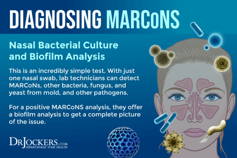 MARCoNS Symptoms, Causes, and Support Strategies MARCoNS Symptoms, Causes, and Support Strategies