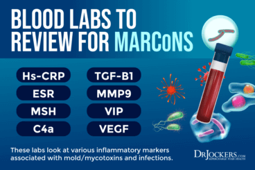 MARCoNS: Symptoms, Causes, and Support Strategies