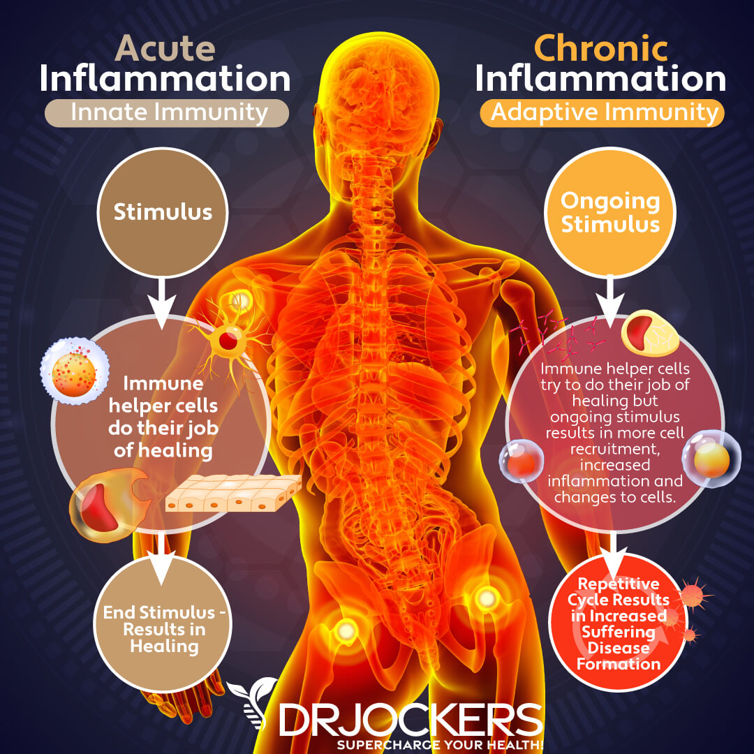 5 Ways To Reduce Inflammation Quickly