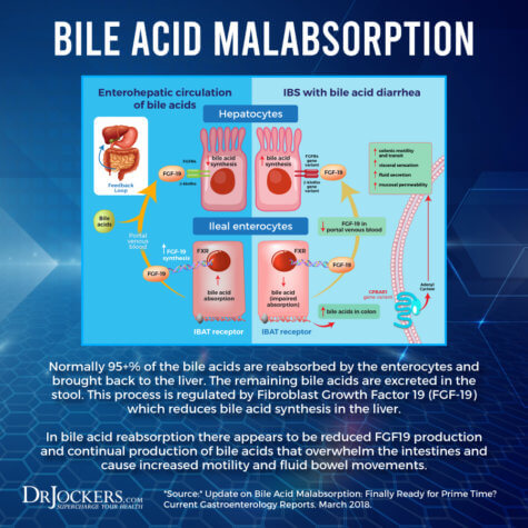 Bile Acid Malabsorption: Symptoms & Solutions - DrJockers.com