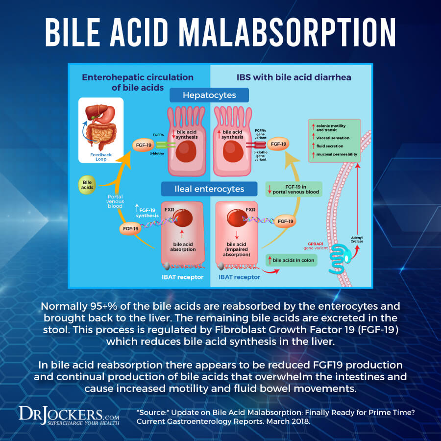 Bile Acid Malabsorption, Bile Acid Malabsorption: Symptoms &#038; Solutions