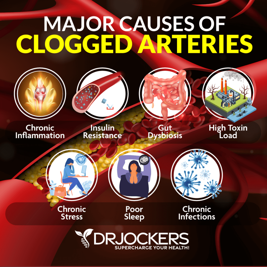 Clogged Arteries: Causes, Symptoms & Support Strategies