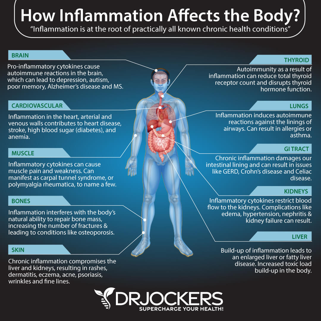 Signs You have Too Much Inflammation In Your Body - Apprentice Doctor