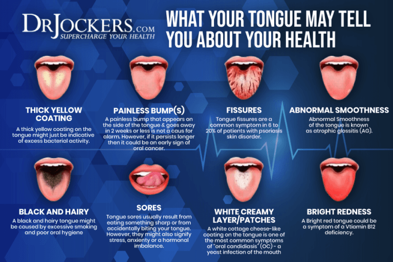 Tongue Mapping To Discover Hidden Health Problems