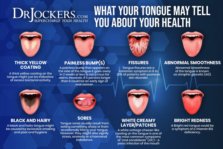 tongue mapping, Tongue Mapping To Discover Hidden Health Problems