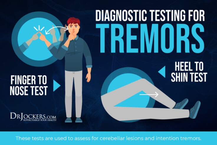 Tremors Root Causes And Natural Support Strategies