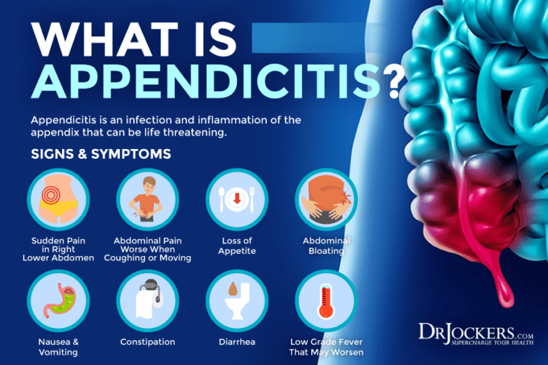 The Appendix: How Important Is This Organ? - DrJockers.com