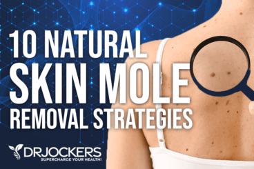 skin moles, Skin Moles: Signs of Cancer and 10 Natural Removal Strategies