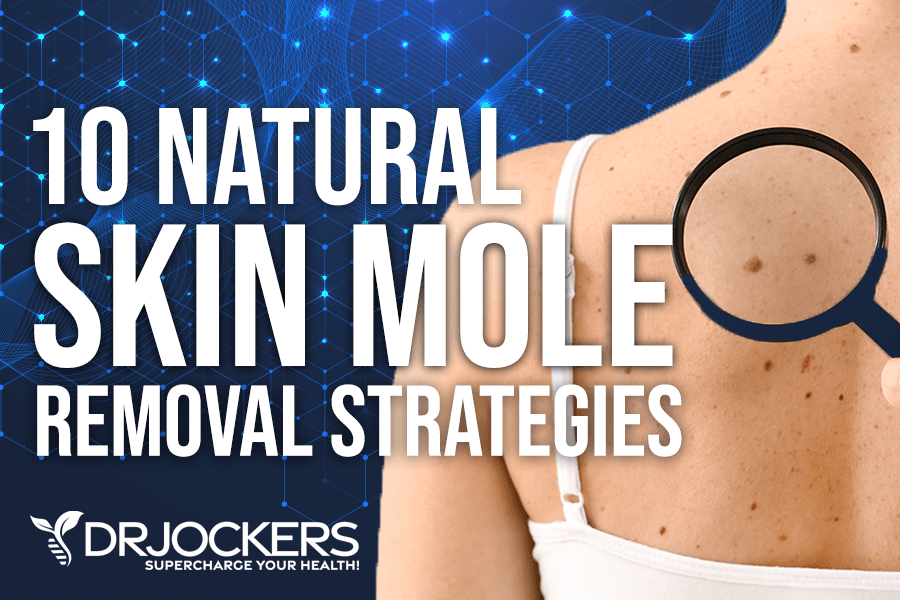 skin moles