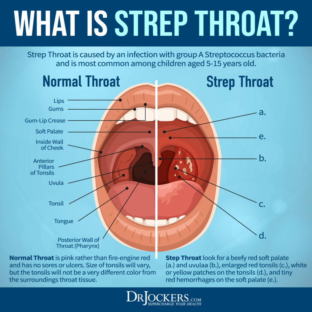 how do you get strep throat        <h3 class=