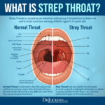 Strep Throat: Symptoms and 15 Natural Support Strategies