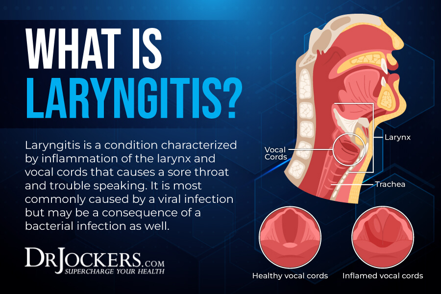 Laryngitis, Laryngitis: Symptoms and Natural Support Strategies