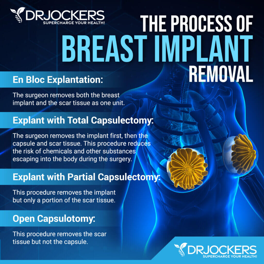 Breast Implant Illness Symptoms And Recovery Support