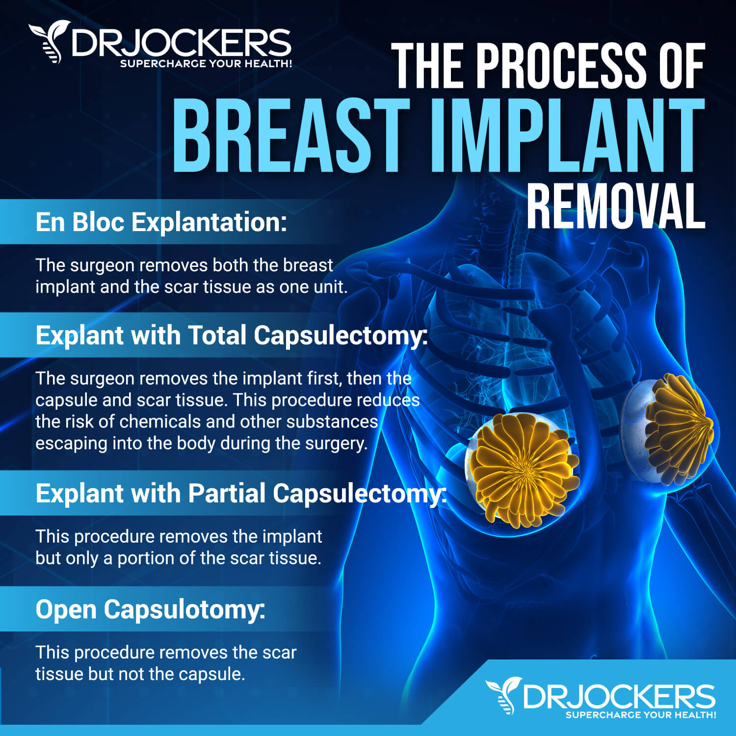 Breast Implant Illness Symptoms And Recovery Support Breast Implant Illness Symptoms And Recovery Support