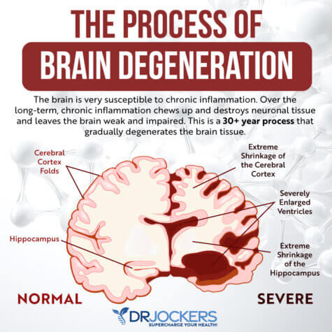 Leaky Brain Syndrome: Symptoms, Causes and Natural Solutions