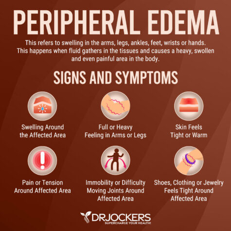 Edema: Symptoms, Causes, And Natural Support Strategies