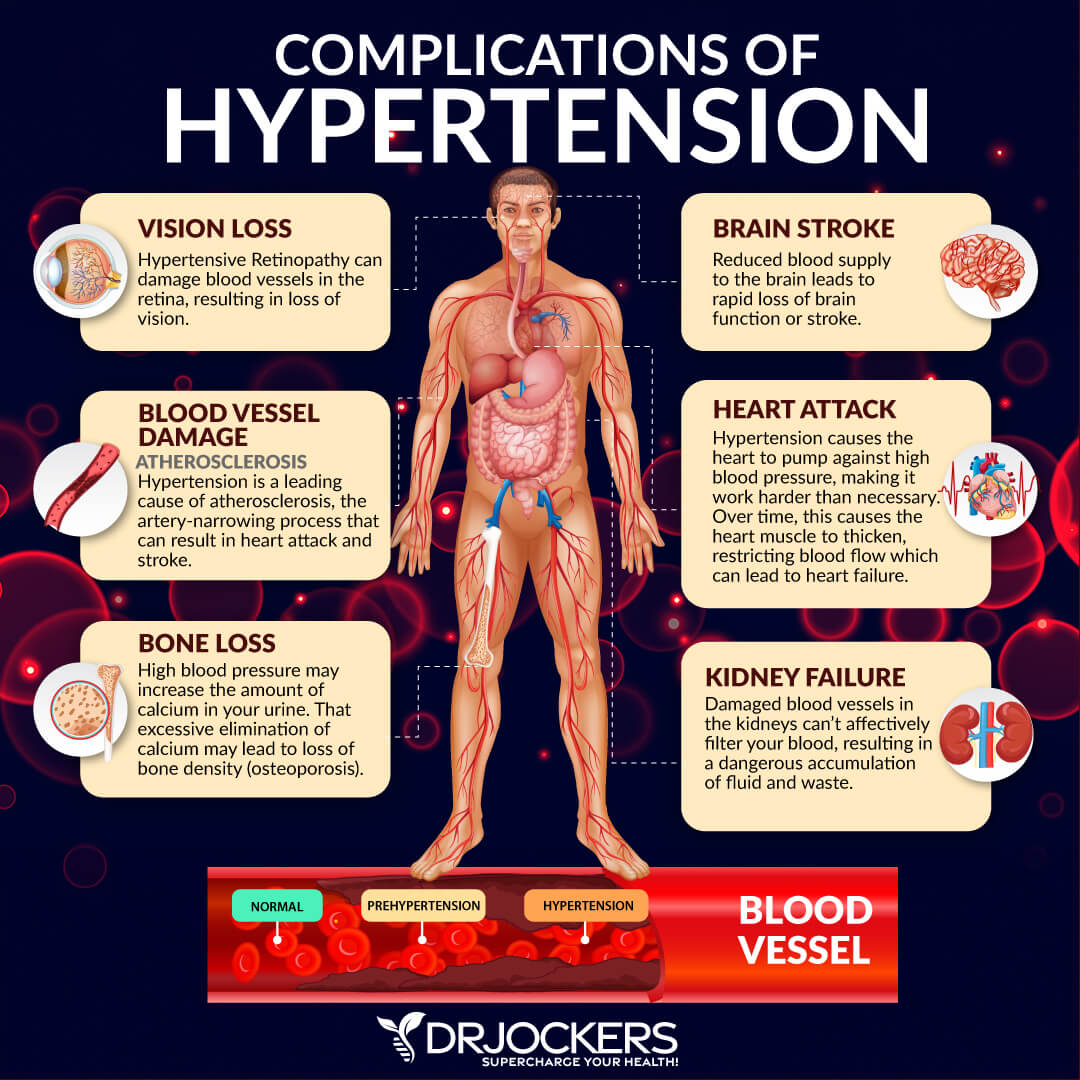 Hypertension – Symptoms, Causes, Types, Complications, Prevention