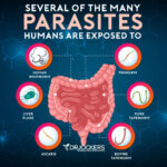 Parasite Infections: Functional Lab Analysis To Identify Parasites