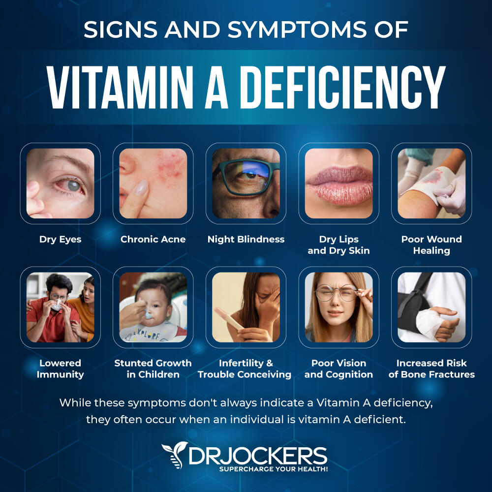 vitamin A